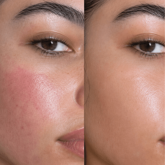 The Skin Transformation Series at Xiomara Studio in Dallas, TX