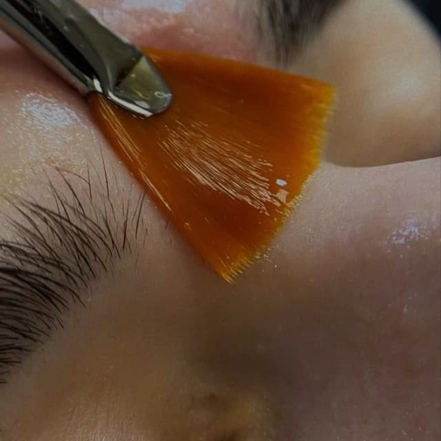 Vitamin C Peel Package 3 at Xiomara Studio in Dallas, TX